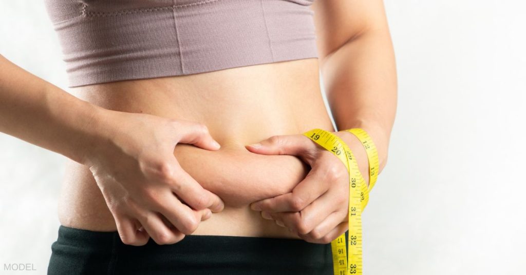 Woman with loose skin after weight loss (model) pinching her stomach with a measuring tape around her hand.