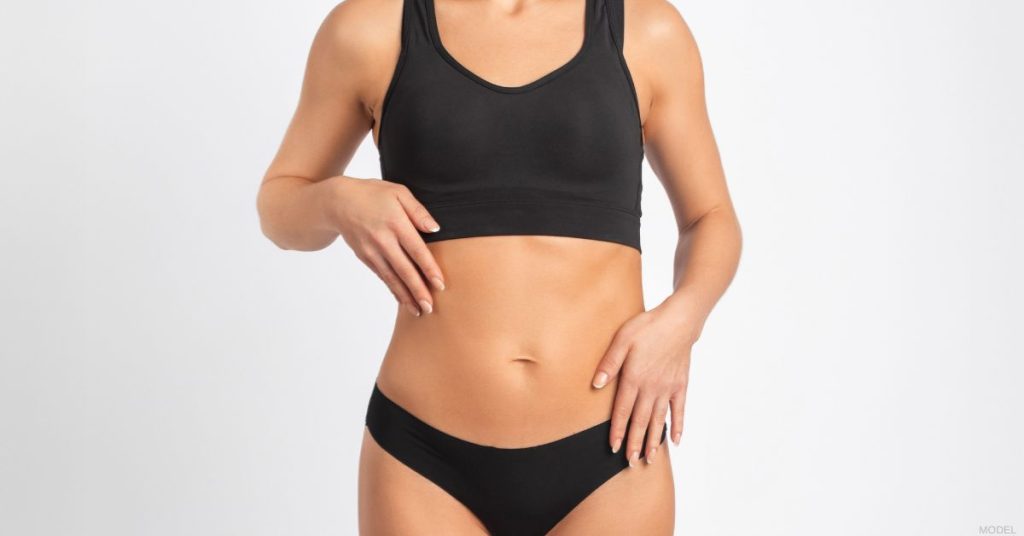 Woman after a drainless tummy tuck. (Model)