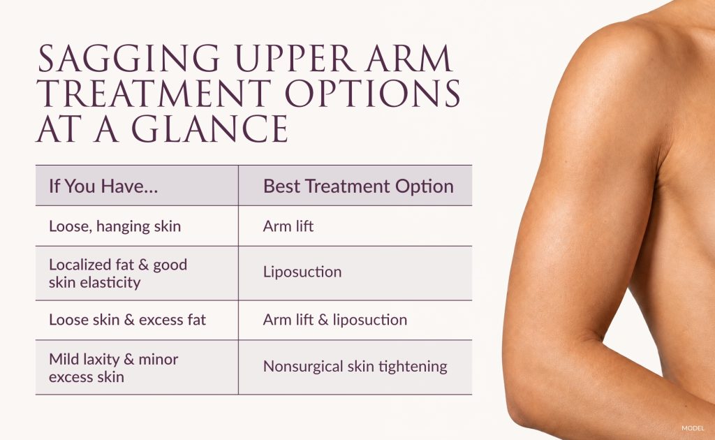Infographic titled "Sagging Upper Arm Treatment Options At A Glance" by Hagopian Plastic Surgery. This includes best treatment options for different concerns.