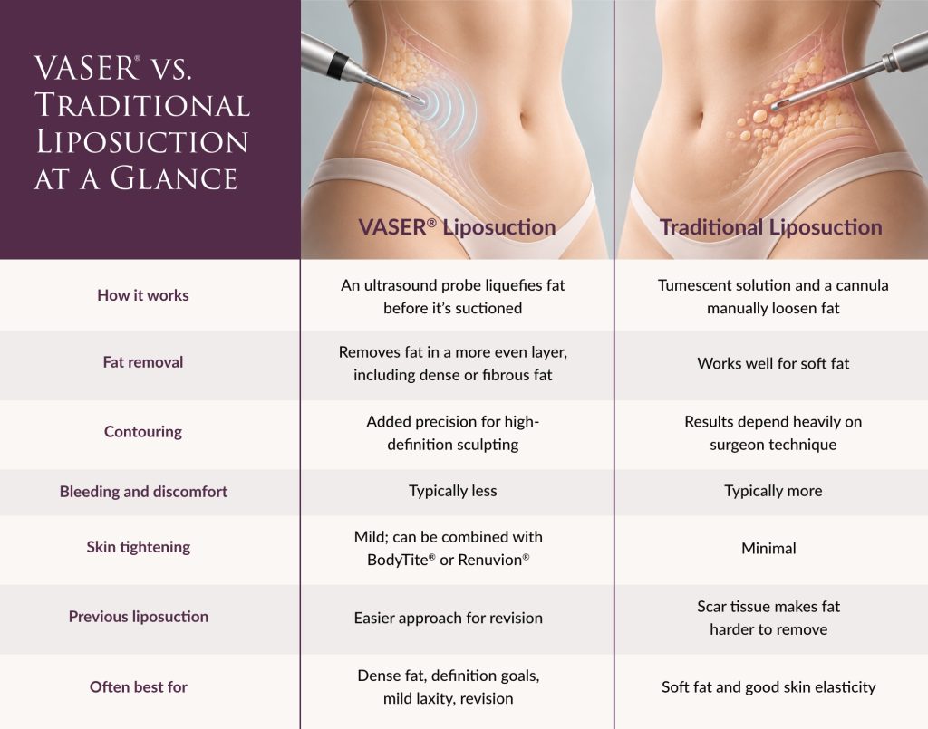 Comparison chart of VASER liposuction and traditional liposuction by technique, fat removal, contouring, recovery comfort, skin tightening, and ideal candidates.