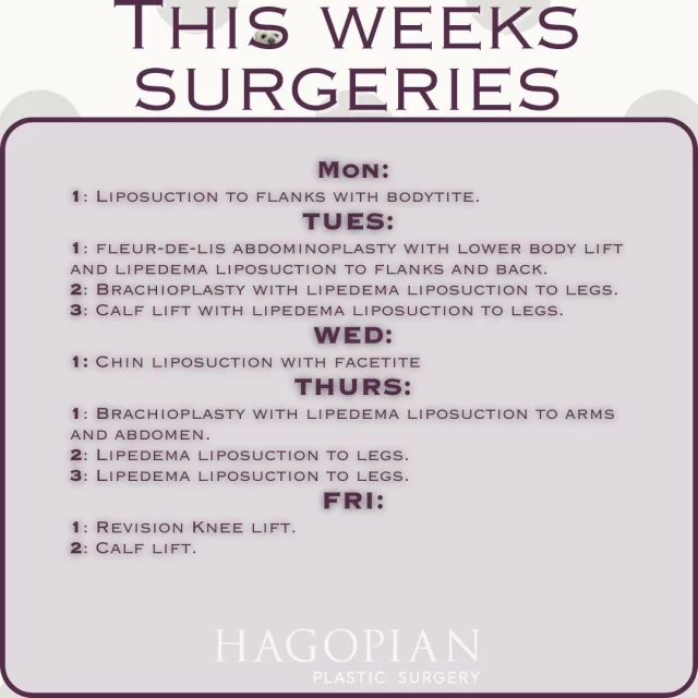 This week in the OR, we’re focusing on procedures that restore balance, comfort, and confidence for patients at every stage of their journey. Monday begins with liposuction paired with BodyTite to refine contour and enhance tissue tightening. Tuesday includes a fleur-de-lis abdominoplasty with a lower body lift and lipedema liposuction, as well as arm and calf procedures designed to improve mobility and reduce discomfort. Wednesday features facial contouring with chin liposuction and FaceTite, followed by a full Thursday of arm and leg-focused lipedema liposuction and brachioplasty. We’ll wrap up the week on Friday with a revision knee lift and calf lift both aimed at helping patients move and feel better in their skin. Each case represents progress, relief, and renewed confidence.
If you would like to see your procedure on this list one day make sure to give the office a call to set up your consultation! 📲 (404)885-8542

If you are interested in taking a closer look at any of these procedures I have before and after pictures of many of these on my website 🌐 www.hagopianplasticsurgery.com 

#drthomashagopian #hagopianplasticsurgery #LipedemaAwareness #thisweekssurgeries #plasticsurgery