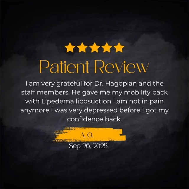 We love our patients and we love hearing your stories. If you’d like to share your own experience with us, please consider leaving a review. It helps patients like you find the care they need.

You can leave us a review on Google here: https://tinyurl.com/ReviewHPS
Or RealSelf here: https://www.realself.com/review/write?dr_id=10872634

Or you can visit our website if you would like to learn more about us: https://www.hagopianplasticsurgery.com/